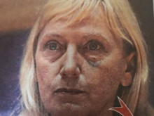 Елена Йончева с насинено око, изглежда неузнаваемо