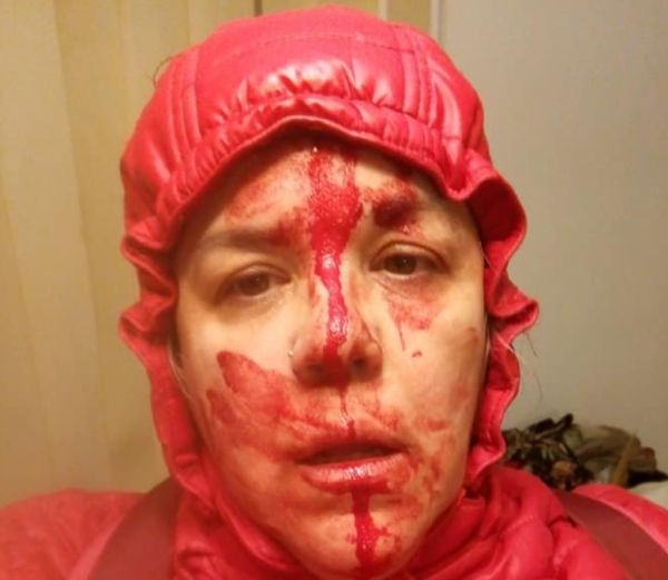 Фейсбук Агресивна мижитурка преби жена която разхождала кучето си в софийската