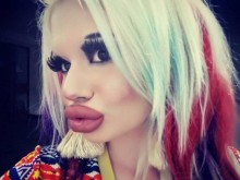 Daily Star: Жена от България иска да има най-големите устни в света