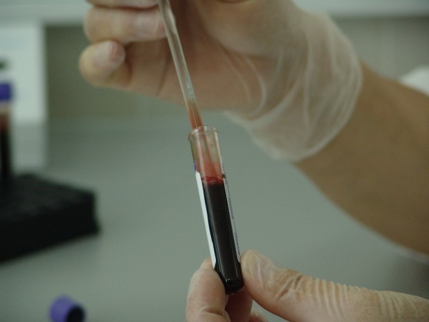 Пробите за коронавирус на 7 от общо 8 човека, настанени