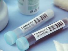 Българин, живеещ в Сингапур, също с положителна проба за COVID-19