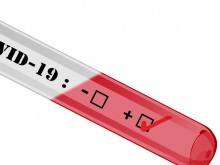 Русия също тества и разработва ваксина срещу COVID-19
