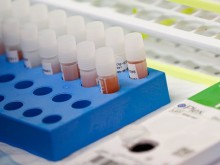 Важно! При пациенти с тези заболявания COVID-19 е особено опасен