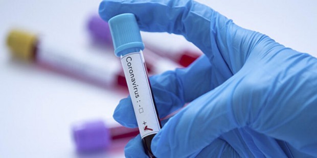 56 са новите случаи на коронавирус у нас за изминалото