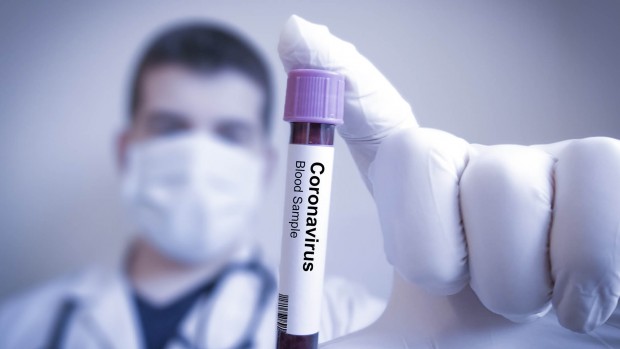 47 нови случая на коронавирус у нас са установени за