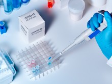 Родни имунолози с предупреждение за ефекта от COVID-19