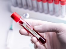Близо 27 000 смъртни случаи от коронавирус във Франция