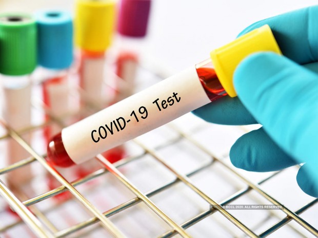132 заразени с коронавирус има у нас за последното денонощие