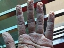 Снимка на ръка на лекар след дежурство става все по-популярна