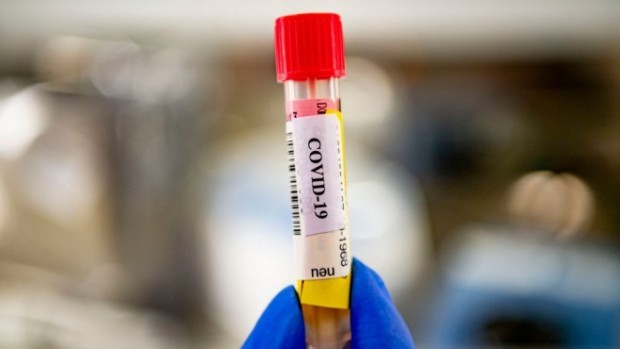 161 са новодиагностицираните с новия коронавирус лица за изминалите 24