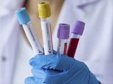240 са новите случаи на коронавирус у нас, 21 в Пловдив
