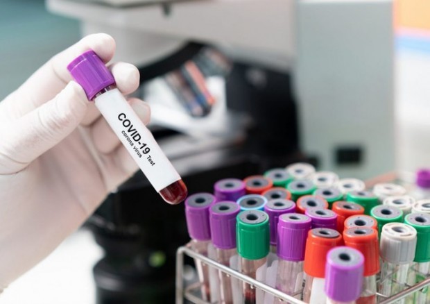 292 са новите случаи на заразени с коронавирус в България за