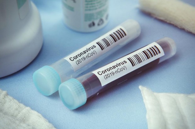 325 са новите случаи на заразени с коронавирус в България за