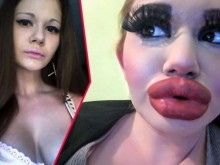 Скандална българка не може да се насити на операции, ще си увеличава и бюста!