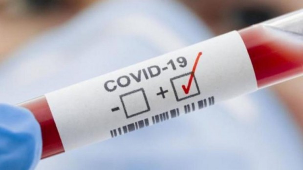 265 са новодиагностицираните с COVID 19 лица през последното денонощие 6639