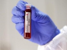 119 са новите случаи на COVID-19 у нас при направени 1491 теста