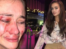 Красавица се оплака, че била пребита от охрана на плаж (18+)