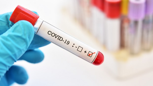 Хората, които прекарват COVID-19 без симптоми, носят същото количество от