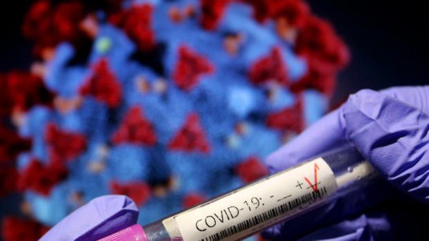 171 са новодиагностицираните с коронавирусна инфекция лица през изминалите 24