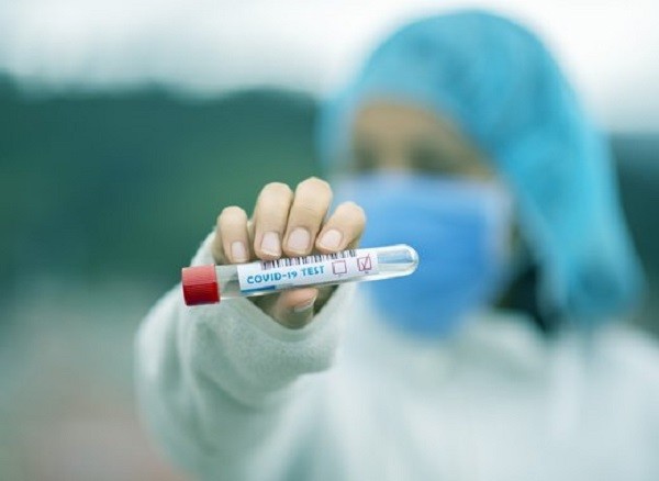 169 са новите случаи на заразени с коронавирус в България за