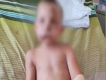 Покъртителен разказ на майката, чието дете бе нахапано от куче край Пловдив