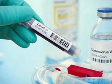 203 са новите случаи на коронавирус у нас, 17 в Пловдив