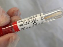 Преминаваме през Сърбия само с отрицателен COVID-19 тест