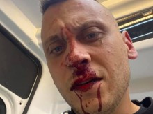 Пребиха един от лидерите на контрапротеста