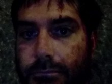 Журналистът Димитър Кенаров бил ритан в главата от полицаи, лежал с часове на паважа