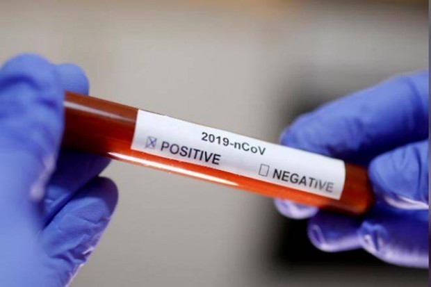 201 са новите случаи на коронавирус у нас през последното